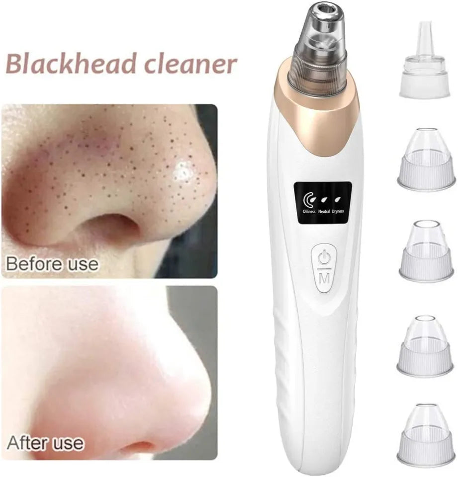 5-in-1 Rechargeable Blackhead Remover – Facial Pore Vacuum with 5 Interchangeable Heads
